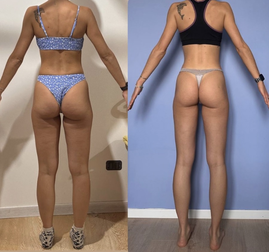 Prima e dopo di una donna di 47 anni, foto di schiena